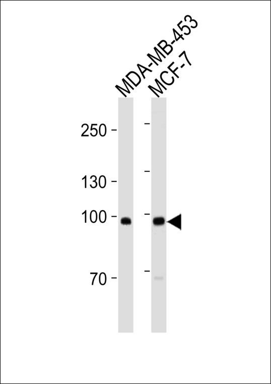 ACE2 / ACE-2 Antibody - ACE2 (SARS Receptor) Antibody western blot of MDA-MB-453, MCF-7 cell line lysates (35 ug/lane). The ACE2 (SARS Receptor) antibody detected the ACE2 (SARS Receptor) protein (arrow).