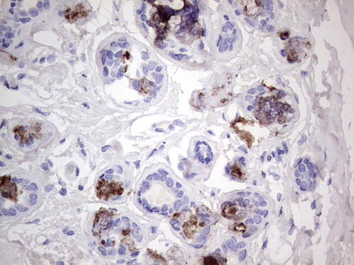 ACE2 / ACE-2 Antibody - IHC of paraffin-embedded Human breast tissue using anti-ACE2 mouse monoclonal antibody. (Heat-induced epitope retrieval by 1 mM EDTA in 10mM Tris, pH8.5, 120°C for 3min).