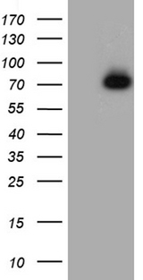 ACE2 / ACE-2 Antibody - HEK293T cells were transfected with the pCMV6-ENTRY control. (Left lane) or pCMV6-ENTRY ACE2. (Right lane) cDNA for 48 hrs and lysed. Equivalent amounts of cell lysates. (5 ug per lane) were separated by SDS-PAGE and immunoblotted with anti-ACE2. (1:2000)