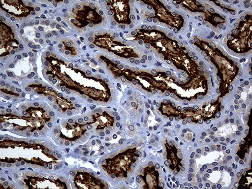 ACE2 / ACE-2 Antibody - Immunohistochemical staining of paraffin-embedded Human Kidney tissue within the normal limits using anti-ACE2 mouse monoclonal antibody. (Heat-induced epitope retrieval by 1mM EDTA in 10mM Tris buffer. (pH8.5) at 120°C for 3 min. (1:500)