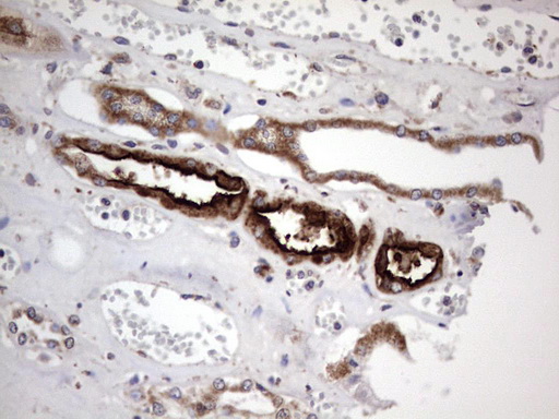 ACE2 / ACE-2 Antibody - IHC of paraffin-embedded Human Kidney tissue using anti-ACE2 mouse monoclonal antibody. (Heat-induced epitope retrieval by 1 mM EDTA in 10mM Tris, pH8.5, 120°C for 3min).