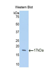 ACE2 / ACE-2 Antibody - Western blot of recombinant ACE2 / ACE-2.  This image was taken for the unconjugated form of this product. Other forms have not been tested.