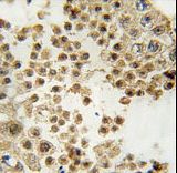 ACE2 / ACE-2 Antibody - Formalin-fixed and paraffin-embedded human testis tissue reacted with ACE2 (SARS Receptor) Antibody , which was peroxidase-conjugated to the secondary antibody, followed by DAB staining. This data demonstrates the use of this antibody for immunohistochemistry; clinical relevance has not been evaluated.