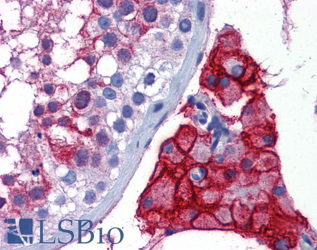 ACE2 / ACE-2 Antibody - Anti-ACE-2 antibody IHC of human testis. Immunohistochemistry of formalin-fixed, paraffin-embedded tissue after heat-induced antigen retrieval. Antibody concentration 5 ug/ml.  This image was taken for the unconjugated form of this product. Other forms have not been tested.