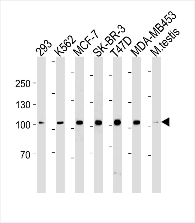 ACE2 / ACE-2 Antibody - ACE2 (SARS Receptor) Antibody western blot of 293,K562,MCF-7,SK-BR-3,T47D,MDA-MB-453 cell line and mouse testis tissue lysates (35 ug/lane). The ACE2 antibody detected the ACE2 protein (arrow).