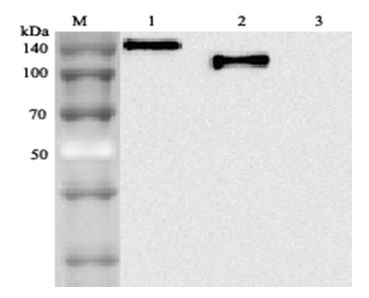 ACE2 / ACE-2 Antibody - Western blot analysis using anti-ACE2 (human), mAb (AC18F) at 1: 2,000 dilution. 1. hACE2 (Fc protein). 2. hACE2 (Ecto domain) (FLAG-tagged). 3. Other hGITR (Fc protein) (control).  This image was taken for the unconjugated form of this product. Other forms have not been tested.