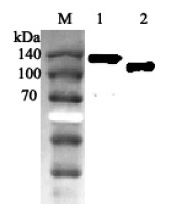 ACE2 / ACE-2 Antibody - Western blot analysis using anti-ACE2 (human), pAb at 1:2000 dilution. 1: Human ACE2 Fc-protein. 2: Human ACE2 (ED) (FLAG-tagged).  This image was taken for the unconjugated form of this product. Other forms have not been tested.