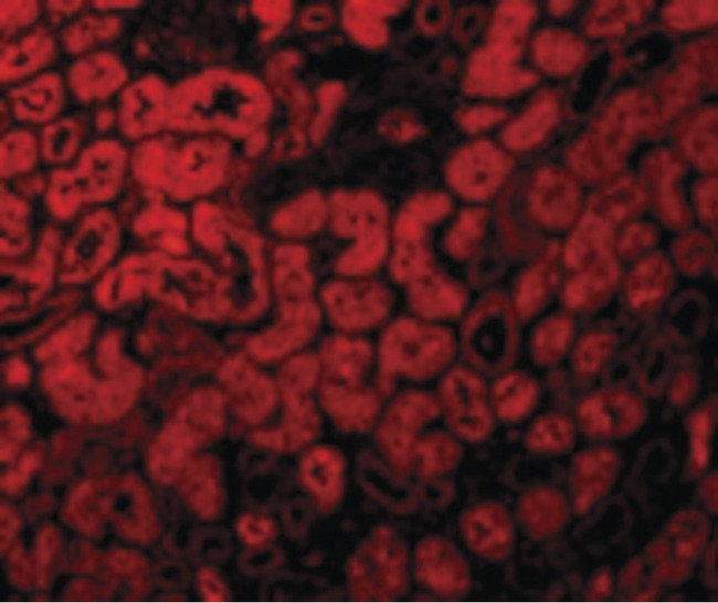 ACE2 / ACE-2 Antibody - Immunofluorescence of ACE2 in Human Kidney cells with ACE2 antibody at 10 ug/ml.