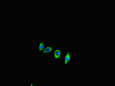 ACE2 / ACE-2 Antibody - Immunofluorescent analysis of HepG2 cells diluted at 1:100 and Alexa Fluor 488-congugated AffiniPure Goat Anti-Rabbit IgG(H+L)