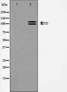 ACE2 / ACE-2 Antibody - Western blot analysis of ACE2 expression in HeLa cells. The lane on the left is treated with the antigen-specific peptide.