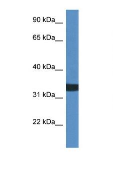 ACER1 / ASAH3 Antibody - ACER1 / ASAH3 antibody Western blot of HCT15 Cell lysate. Antibody concentration 1 ug/ml.  This image was taken for the unconjugated form of this product. Other forms have not been tested.
