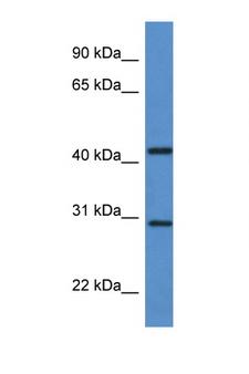 ACER1 / ASAH3 Antibody - ACER1 / ASAH3 antibody Western blot of Fetal Brain lysate. Antibody concentration 1 ug/ml.  This image was taken for the unconjugated form of this product. Other forms have not been tested.