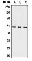ACER1 / ASAH3 Antibody - Western blot analysis of ACER1 expression in HepG2 (A); Raw264.7 (B); H9C2 (C) whole cell lysates.