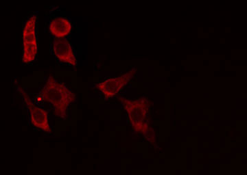 ACER1 / ASAH3 Antibody - Staining HepG2 cells by IF/ICC. The samples were fixed with PFA and permeabilized in 0.1% Triton X-100, then blocked in 10% serum for 45 min at 25°C. The primary antibody was diluted at 1:200 and incubated with the sample for 1 hour at 37°C. An Alexa Fluor 594 conjugated goat anti-rabbit IgG (H+L) antibody, diluted at 1/600, was used as secondary antibody.