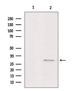 ACER1 / ASAH3 Antibody - Western blot analysis of extracts of HeLa cells using ASAH3 antibody. Lane 1 was treated with the blocking peptide.