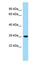 ACER2 Antibody - ACER2 antibody Western Blot of Fetal Lung.  This image was taken for the unconjugated form of this product. Other forms have not been tested.