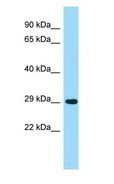 ACER2 Antibody - ACER2 antibody Western Blot of Fetal Lung.  This image was taken for the unconjugated form of this product. Other forms have not been tested.