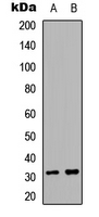 ACER2 Antibody - Western blot analysis of ACER2 expression in A549.MCF7 (A); PC12 (B) whole cell lysates.