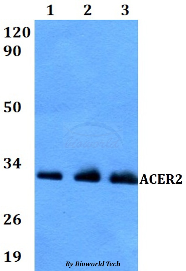ACER2 Antibody - Western blot of ACER2 antibody at 1:500 dilution. Lane 1: A549 whole cell lysate. Lane 2: MCF-7 whole cell lysate. Lane 3: PC12 whole cell lysate.