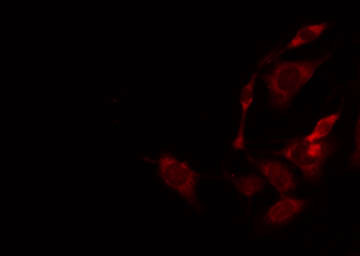 ACER2 Antibody - Staining HeLa cells by IF/ICC. The samples were fixed with PFA and permeabilized in 0.1% Triton X-100, then blocked in 10% serum for 45 min at 25°C. The primary antibody was diluted at 1:200 and incubated with the sample for 1 hour at 37°C. An Alexa Fluor 594 conjugated goat anti-rabbit IgG (H+L) Ab, diluted at 1/600, was used as the secondary antibody.