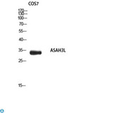 ACER2 Antibody - Immunohistochemistry (IHC) analysis of paraffin-embedded Human Liver, antibody was diluted at 1:200.