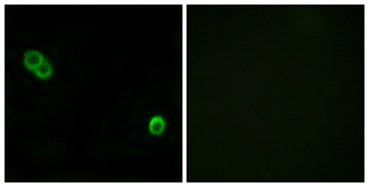 ACER3 Antibody - Immunofluorescence analysis of MCF7 cells, using PHCA Antibody. The picture on the right is blocked with the synthesized peptide.