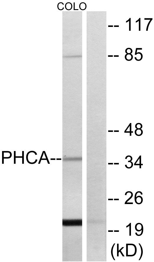 ACER3 Antibody - Western blot analysis of lysates from COLO cells, using PHCA Antibody. The lane on the right is blocked with the synthesized peptide.