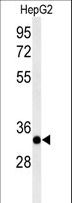 ACER3 Antibody - Western blot of ACER3 Antibody in HepG2 cell line lysates (35 ug/lane). ACER3 (arrow) was detected using the purified antibody.