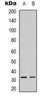 ACER3 Antibody - Western blot analysis of ACER3 expression in HepG2 (A); COLO205 (B) whole cell lysates.