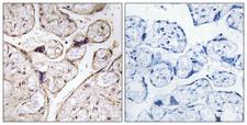 ACER3 Antibody - Peptide - + Immunohistochemistry analysis of paraffin-embedded human placenta tissue using PHCA antibody.