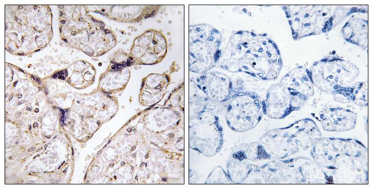 ACER3 Antibody - Peptide - + Immunohistochemistry analysis of paraffin-embedded human placenta tissue using PHCA antibody.