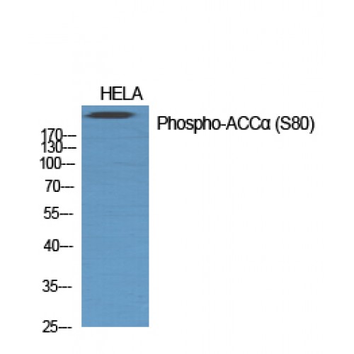 Acetyl-CoA Carboxylase / ACC Antibody - Western blot of Phospho-ACCalpha (S80) antibody