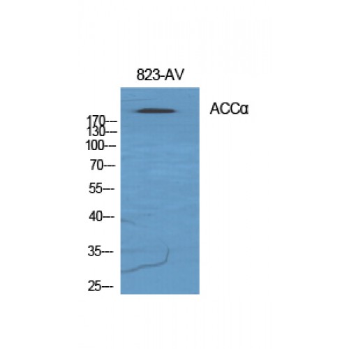 Acetyl-CoA Carboxylase / ACC Antibody - Western blot of ACCalpha antibody