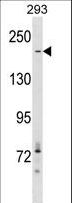Acetyl-CoA Carboxylase / ACC Antibody - ACACA Antibody western blot of 293 cell line lysates (35 ug/lane). The ACACA antibody detected the ACACA protein (arrow).