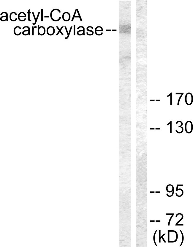 Acetyl-CoA Carboxylase / ACC Antibody - Western blot analysis of lysates from NIH/3T3 cells, treated with PMA 125ng/ml 15', using Acetyl-CoA Carboxylase Antibody. The lane on the right is blocked with the synthesized peptide.