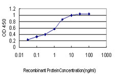 Acetyl-CoA Carboxylase / ACC Antibody - Detection limit for recombinant GST tagged ACACA is approximately 0.03 ng/ml as a capture antibody.