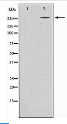 Acetyl-CoA Carboxylase / ACC Antibody - Western blot of ACC1 expression in PMA treated NIH-3T3 whole cell lysates,The lane on the left is treated with the antigen-specific peptide.