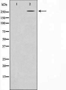Acetyl-CoA Carboxylase / ACC Antibody - Western blot analysis of ACC1 expression in PMA treated NIH-3T3 whole cells lysates. The lane on the left is treated with the antigen-specific peptide.