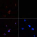 Acetyl-CoA Carboxylase / ACC Antibody - Immunofluorescence analysis of 293T cells using ACACA Polyclonal Antibody at dilution of 1:100.293T cells were treated by Hydrogen Peroxide (2 nM) at 37? for 15 minutes after serum-starvation overnight(left).Blue: DAPI for nuclear staining.