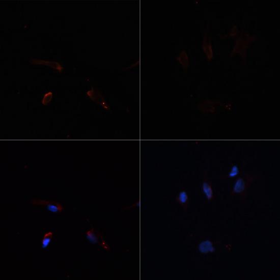 Acetyl-CoA Carboxylase / ACC Antibody - Immunofluorescence analysis of C6 cells using ACACA Polyclonal Antibody at dilution of 1:100.C6 cells were treated by Hydrogen Peroxide (2 nM) at 37? for 15 minutes after serum-starvation overnight(left).Blue: DAPI for nuclear staining.