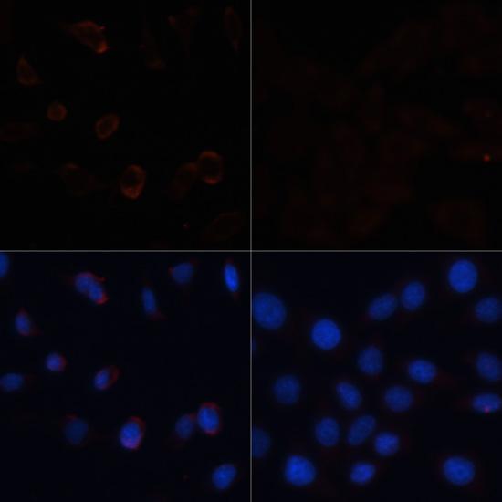 Acetyl-CoA Carboxylase / ACC Antibody - Immunofluorescence analysis of HeLa cells using ACACA Polyclonal Antibody at dilution of 1:100.HeLa cells were treated by Hydrogen Peroxide (2 nM) at 37? for 15 minutes after serum-starvation overnight(left).Blue: DAPI for nuclear staining.