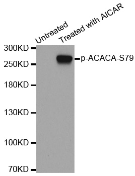 Acetyl-CoA Carboxylase / ACC Antibody - Western blot analysis of extracts from 293 cells.