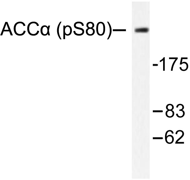 Acetyl-CoA Carboxylase / ACC Antibody - Western blot of p-ACC alpha (S80) pAb in extracts from NIH-3T3 cells treated with PMA.