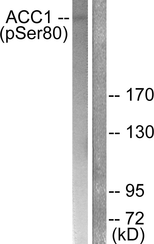 Acetyl-CoA Carboxylase / ACC Antibody - Western blot analysis of lysates from K562 cells treated with Insulin 0.01U/ml 15', using ACC1 (Phospho-Ser80) Antibody. The lane on the right is blocked with the phospho peptide.