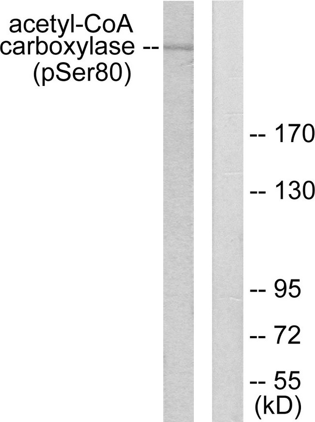 Acetyl-CoA Carboxylase / ACC Antibody - Western blot analysis of lysates from 293 cells treated with EGF 200ng/ml 5', using Acetyl-CoA Carboxylase (Phospho-Ser80) Antibody. The lane on the right is blocked with the phospho peptide.