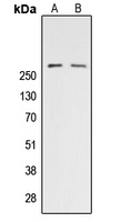 Acetyl-CoA Carboxylase / ACC Antibody - Western blot analysis of ACC alpha (pS80) expression in HeLa (A); NIH3T3 PMA-treated (B) whole cell lysates.