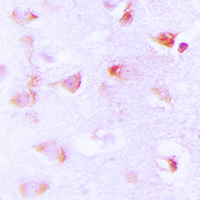 Acetyl-CoA Carboxylase / ACC Antibody - Immunohistochemical analysis of ACC alpha (pS80) staining in human brain formalin fixed paraffin embedded tissue section. The section was pre-treated using heat mediated antigen retrieval with sodium citrate buffer (pH 6.0). The section was then incubated with the antibody at room temperature and detected using an HRP conjugated compact polymer system. DAB was used as the chromogen. The section was then counterstained with hematoxylin and mounted with DPX. w