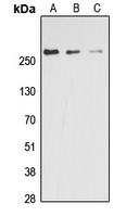 Acetyl-CoA Carboxylase / ACC Antibody - Western blot analysis of ACC alpha (pS80) expression in A431 (A); HepG2 (B); NIH3T3 (C) whole cell lysates.