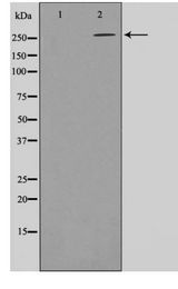 Acetyl-CoA Carboxylase / ACC Antibody - Western blot of ACC1 phosphorylation expression in Insulin treated K562 whole cell lysates,The lane on the left is treated with the antigen-specific peptide.