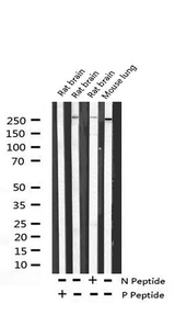 Acetyl-CoA Carboxylase / ACC Antibody - Western blot analysis of Phospho-ACC1 (Ser80) expression in various lysates